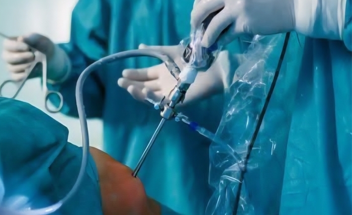 تونس تحتضن الدورة الثالثة والعشرون للمؤتمر الوطني للجمعية التونسية للجراحة بالمنظار، يومي 16 و17 أفريل 2026